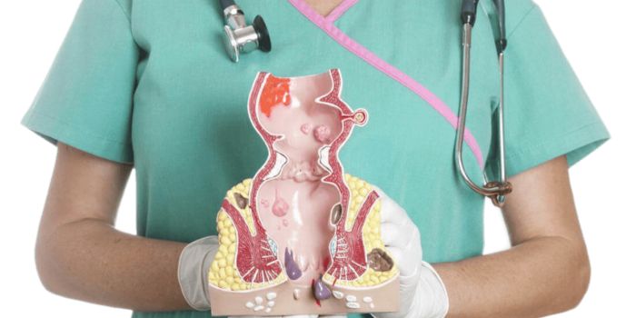 Top-Rated Fissure Treatment in Delhi by Experienced Specialists